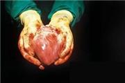 فیلمی جالب و دیدنی از تپش قلب خارج شده از بدن انسان