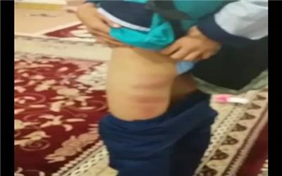 باز هم تکرار ماجرای تلخ تنبیه‌بدنی دانش‌آموز در مدرسه