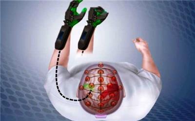 ژن حیاتی برای بهبود بعد از سکته شناسایی شد