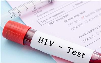 چگونه عفونت HIV بیماری "ایدز" نمی‌شود؟!