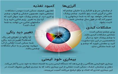 بیماری‌هایی که نشانه‌های آن در چشم‌ها ظاهر می‌شود + اینفوگرافی
